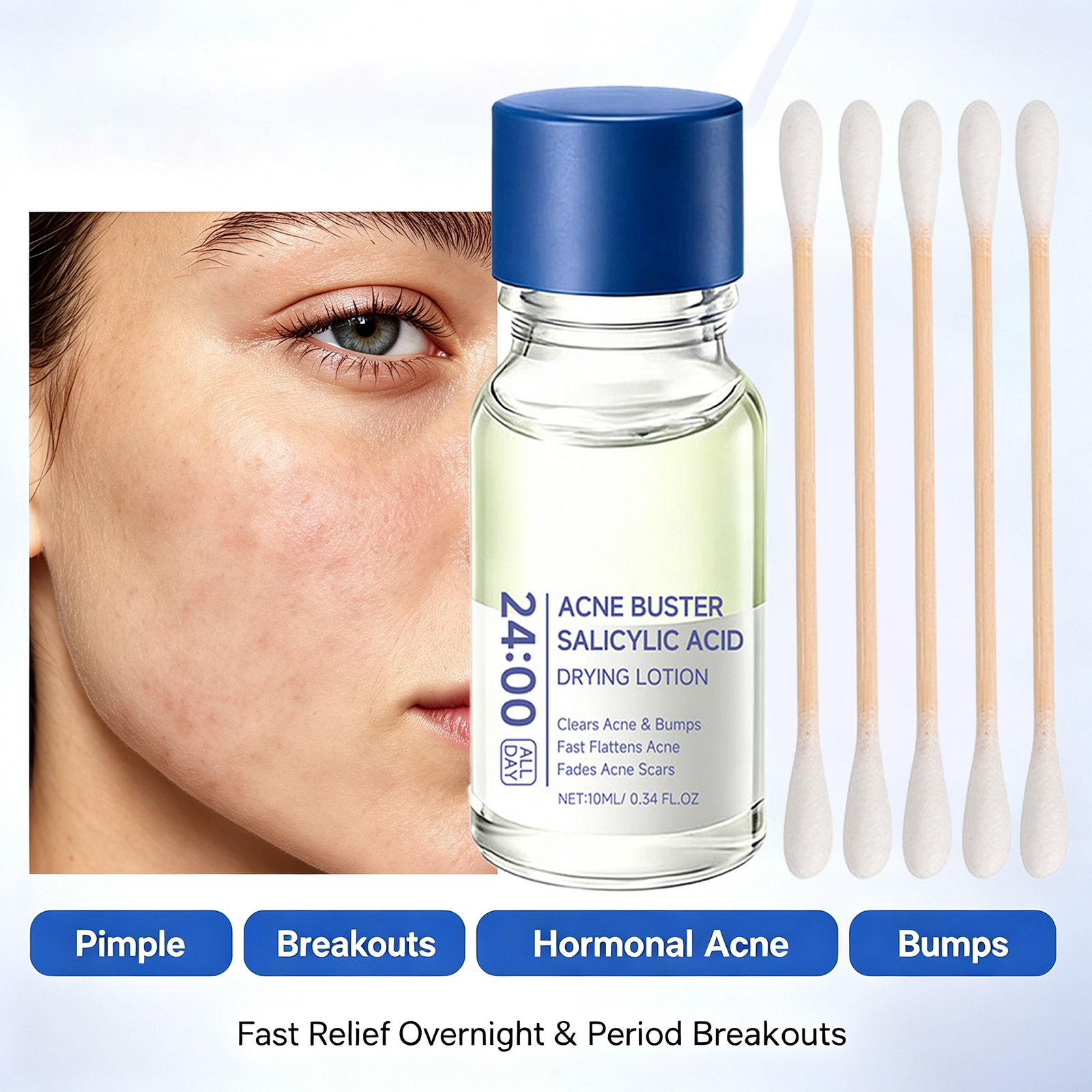 Tranexamic Acid Serum - Salisilik Asit Sivilce Tedavi Serumu, Niacinamide