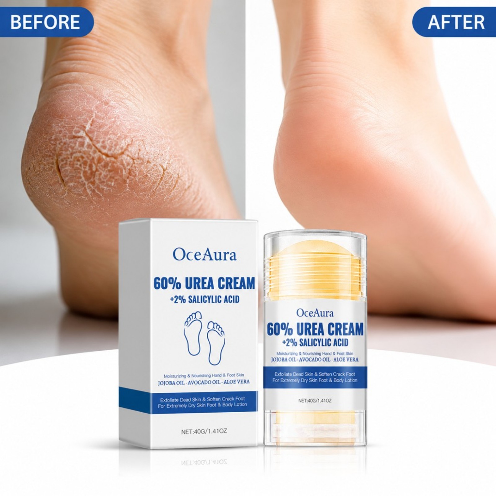 %60 Üre İçeren Ayak Bakım Krem - Urea Foot Cream incelemesi ve fiyatı