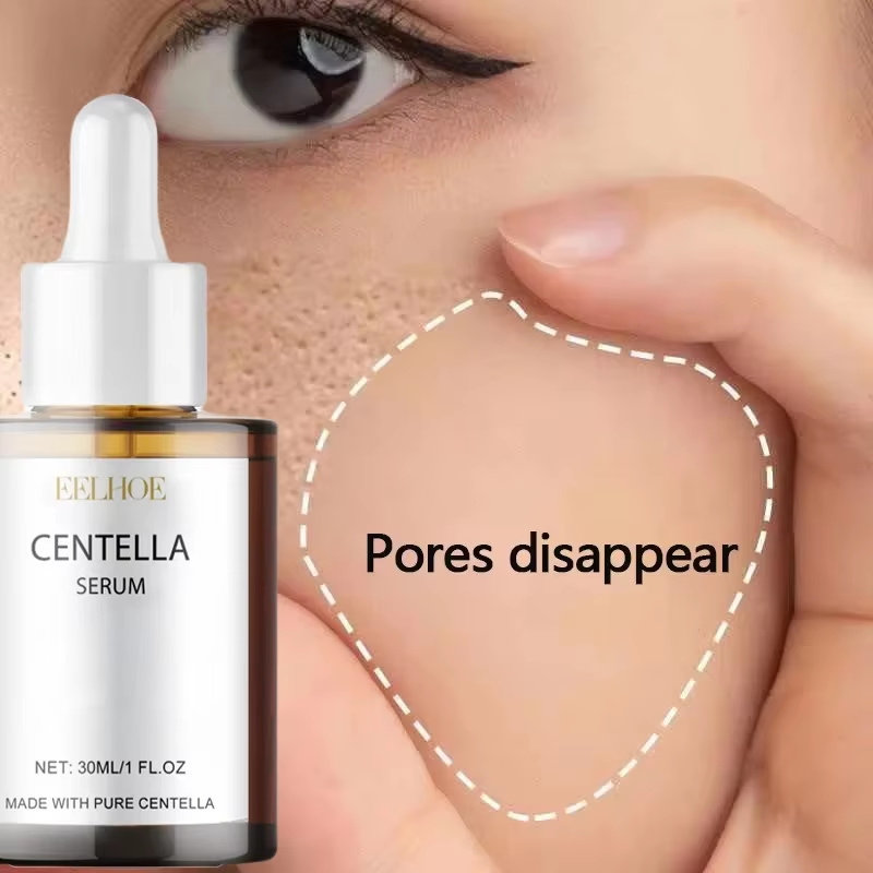 Centella Asiatica Gözenekleri  - Centella Asiatica Toner incelemesi ve fiyatı